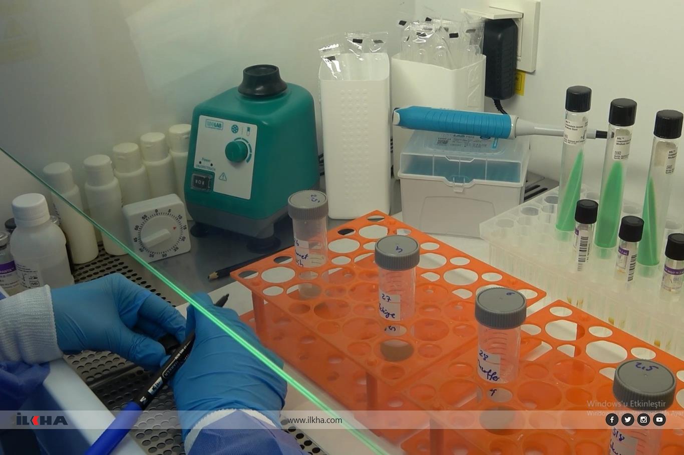 Tüberküloz (Verem) hastalığı nedir?