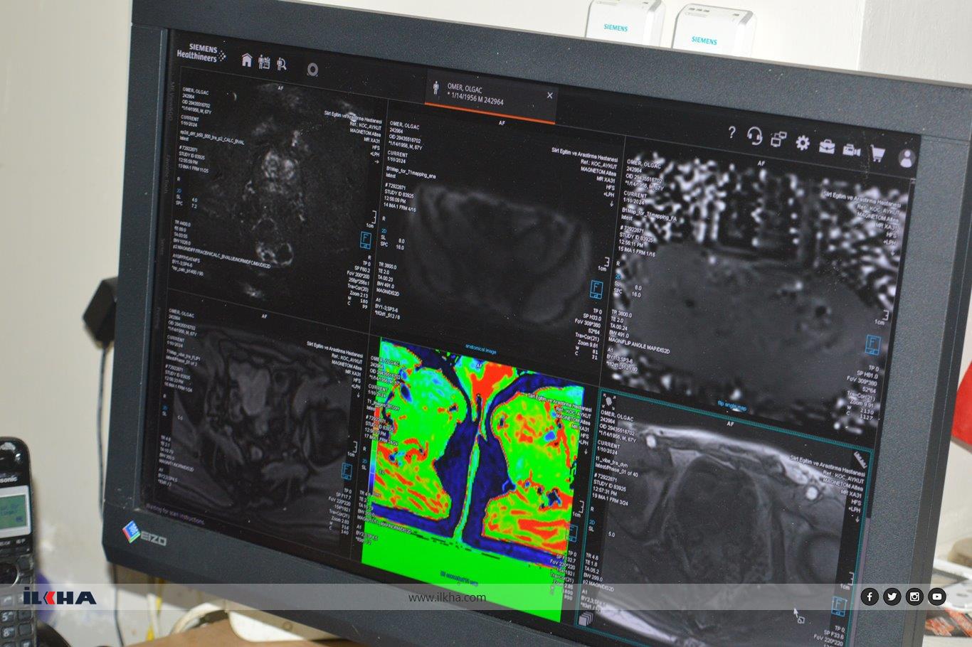 Doç. Dr. Durmuş, prostat kanseri tanısında biyopsi yönteminin önemini vurguladı