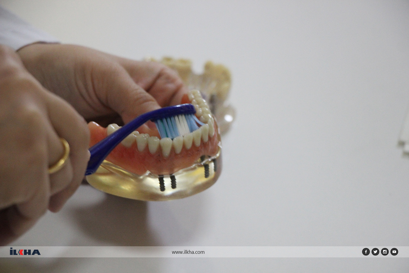 Uzm. Dt. Ünlü: Erken süt dişi kaybı çene bozukluklarına yol açıyor