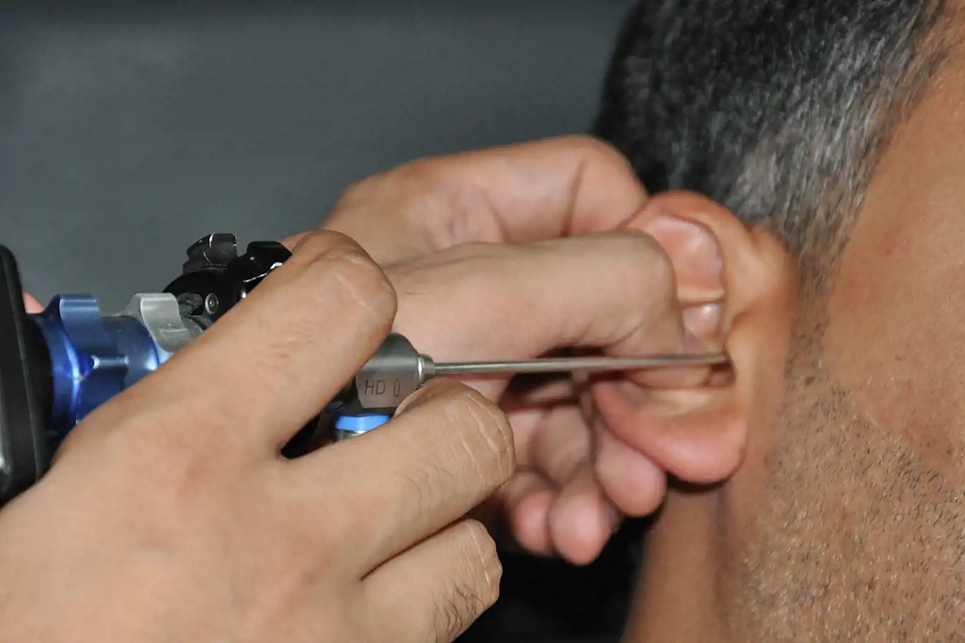 Kulak temizliği nasıl olmalı? Uzman doktor uyardı! Kulak temizliği nasıl olmalı? Uzman doktor uyardı!