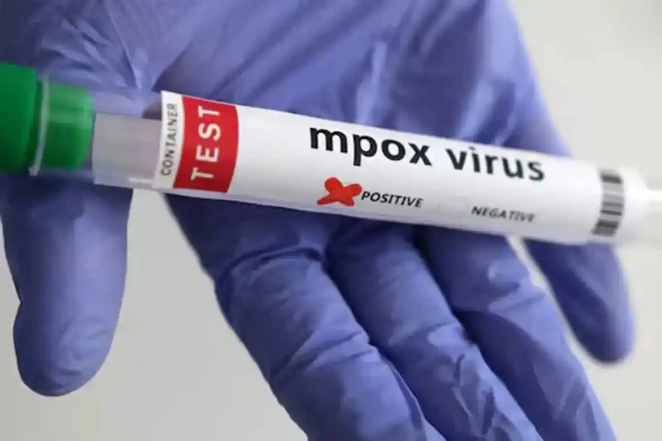 Kenya urges strict adherence to mpox preventive measures amid rising cases Kenya urges strict adherence to mpox preventive measures amid rising cases