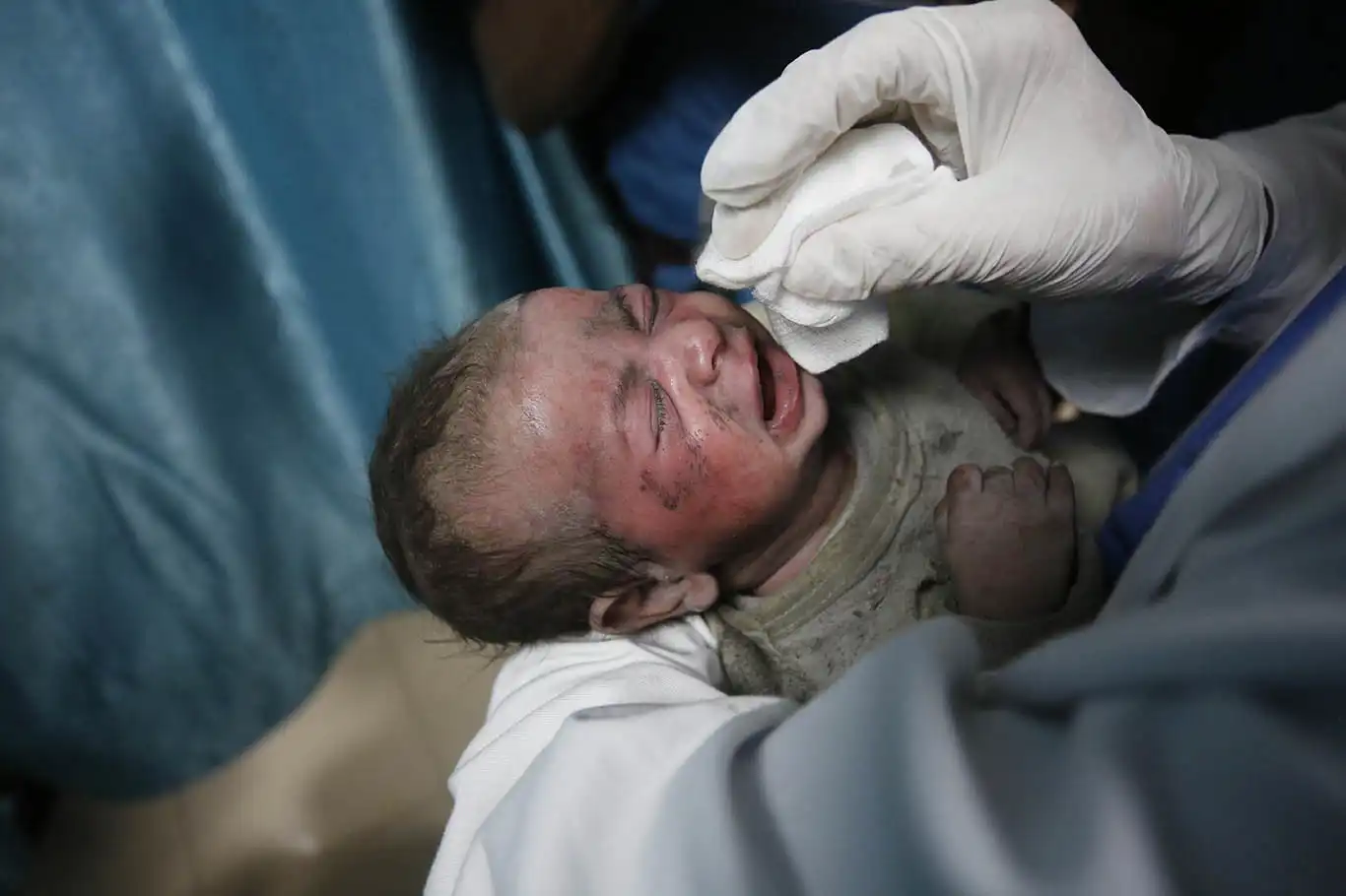 Dr. Mark Perlmutter: Gaza's civilian carnage unmatched by any disaster I've seen Dr. Mark Perlmutter: Gaza's civilian carnage unmatched by any disaster I've seen