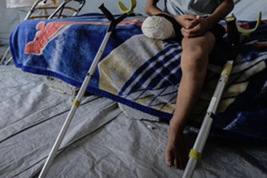 Medical officials: More than 6,000 amputations performed since start of Gaza genocide