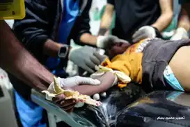 Gazze’de yürek burkan an: Yaralı çocuk hastaneye kanlı ekmeğiyle getirildi