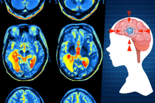 Scientists identify five key phases of brain development across lifespan