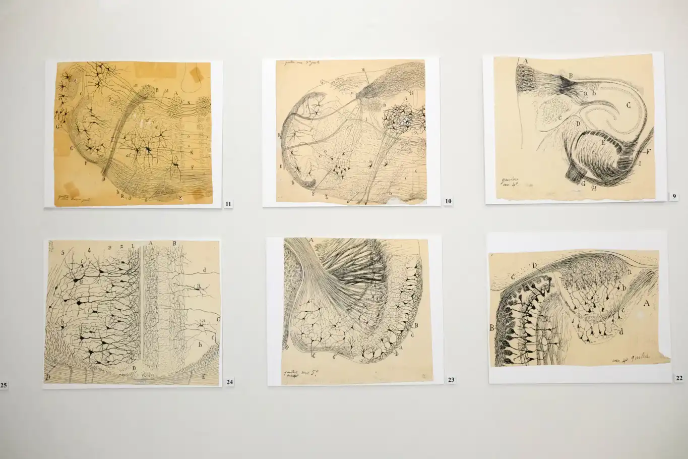 Migrenin kökeni aydınlanıyor: NÖROM’dan bağırsak–beyin eksenini gösteren çarpıcı bulgular