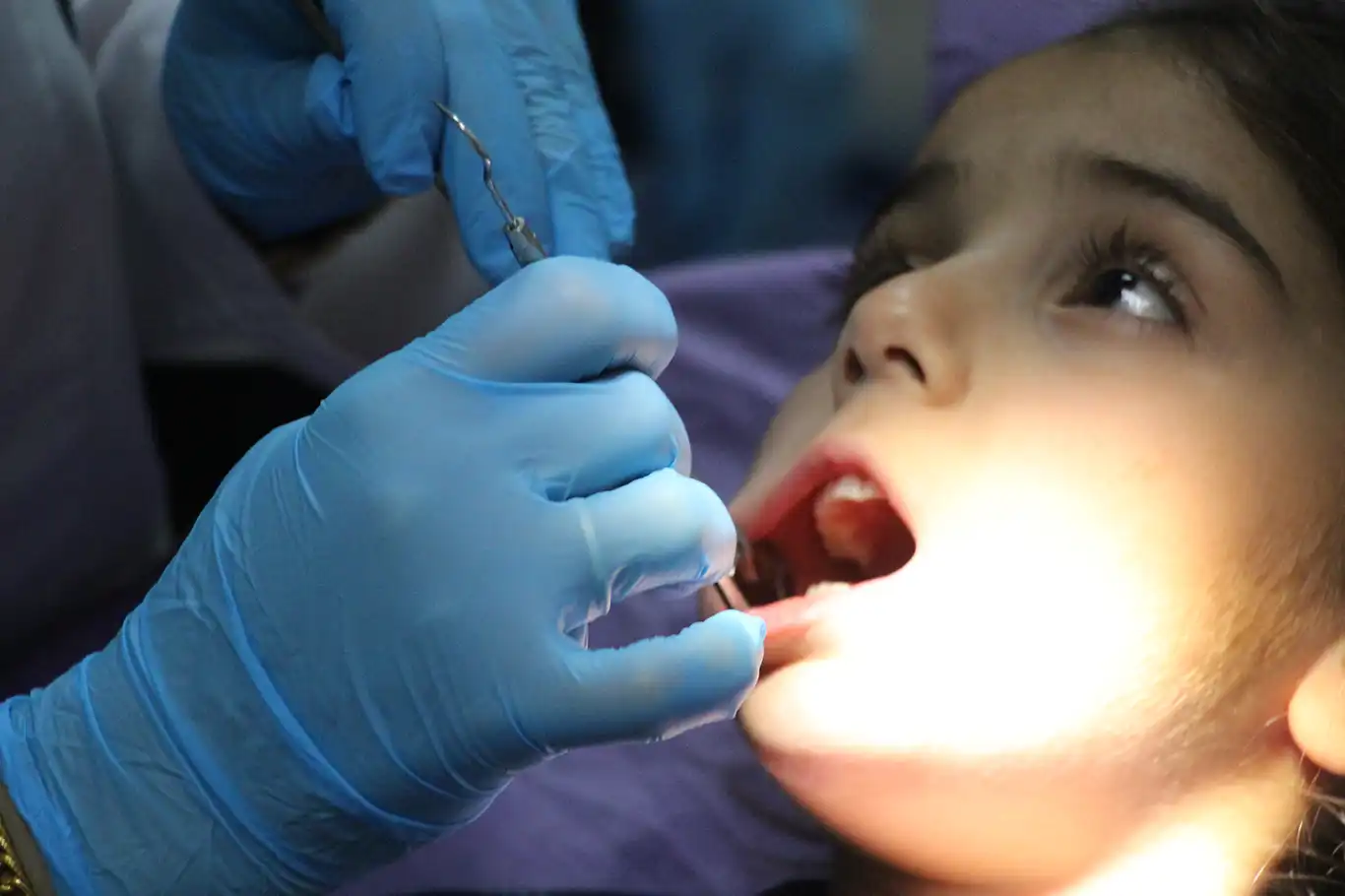 Uzm. Dt. Ünlü: Erken süt dişi kaybı çene bozukluklarına yol açıyor