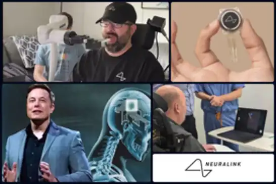 Beyin çipi sınırları aşıyor: Neuralink hastaları düşünce gücüyle robotik kol kontrolüne başladı