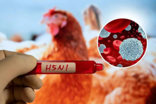 Mexico reports first human death from H5N1 bird flu in Coahuila
