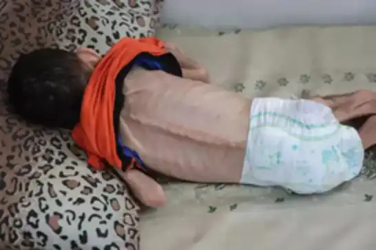 NY: Li Xezzeyê birçîbûnî, nexweşîn û mirinên komî li ber derî ne