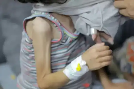 الأونروا: أكثر من 66 ألف طفل في غزة يواجهون خطر المجاعة