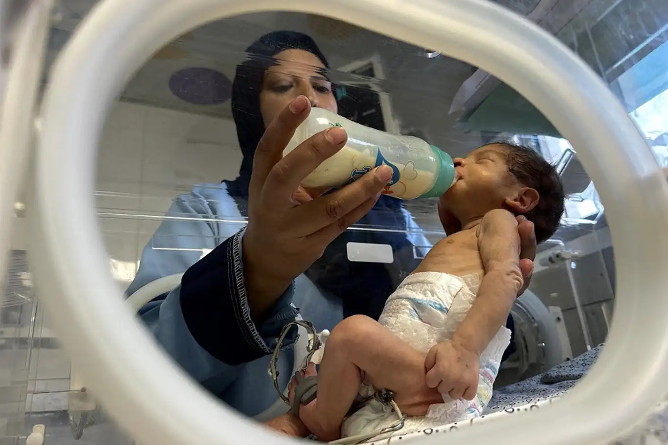Gazze'de açlıktan iki bebek daha hayatını kaybetti Gazze'de açlıktan iki bebek daha hayatını kaybetti