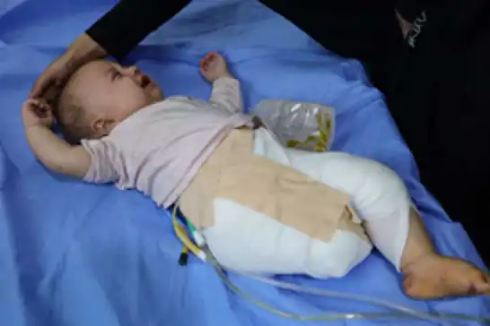 Minik Hani'nin ayağı siyonist bombalarla koparıldı, gülüşü de susturuldu