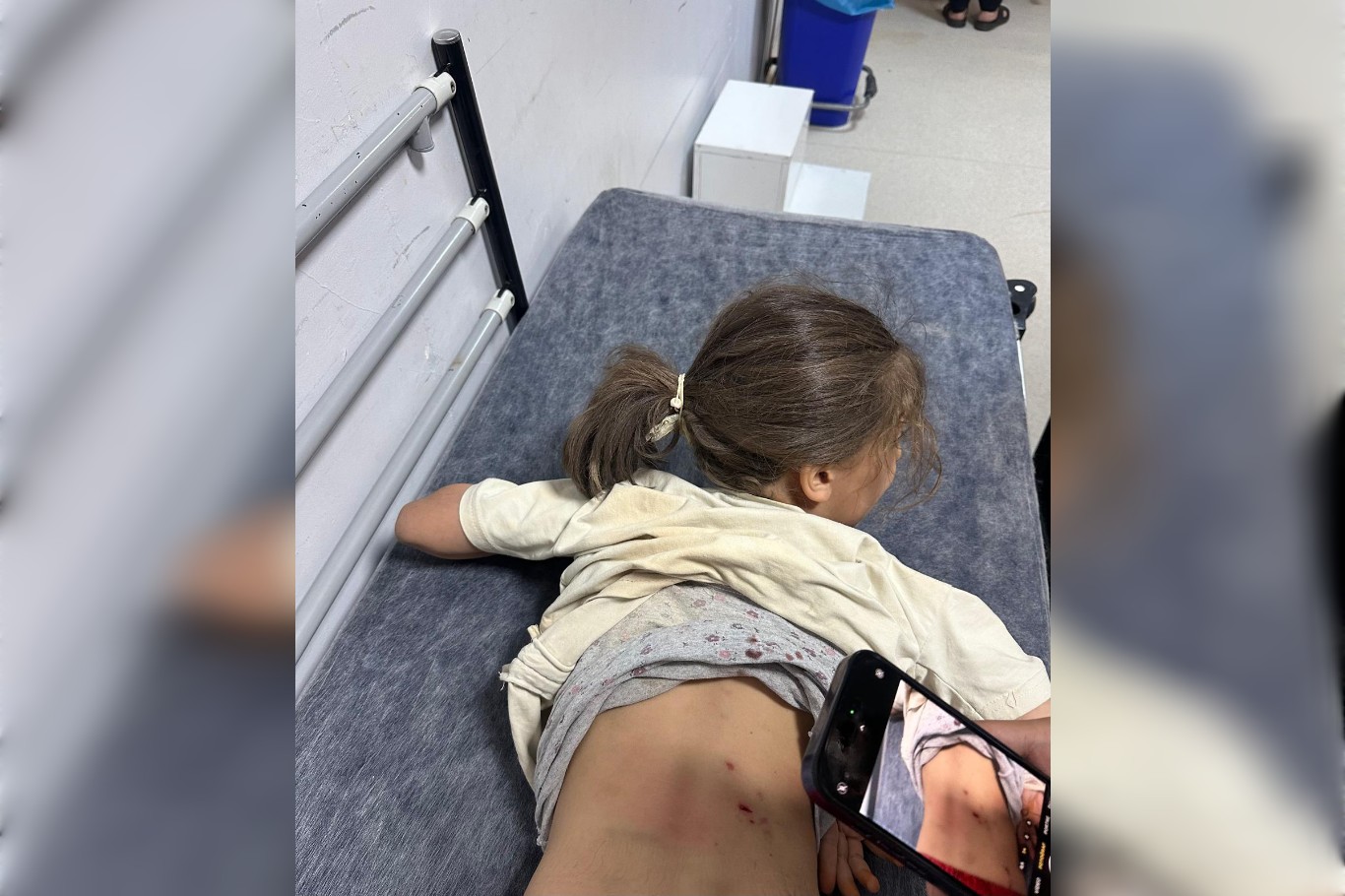 Mardin’de 7 yaşındaki Zeynep’e 3 sokak köpeği saldırdı Mardin’de 7 yaşındaki Zeynep’e 3 sokak köpeği saldırdı