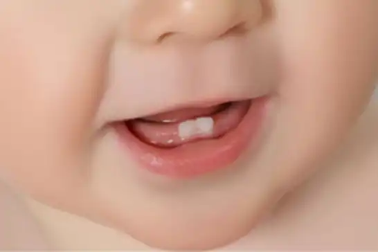 Diş çıkarma döneminde dikkat edilmesi gerekenler