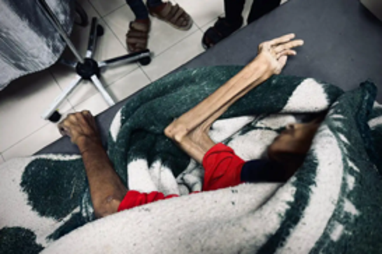 UN sounds alarm over worsening hunger crisis in Gaza