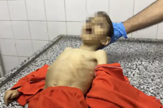 Açlık Gazze'de çocukları vurmaya devam ediyor: 3 günde 21 çocuk şehit oldu