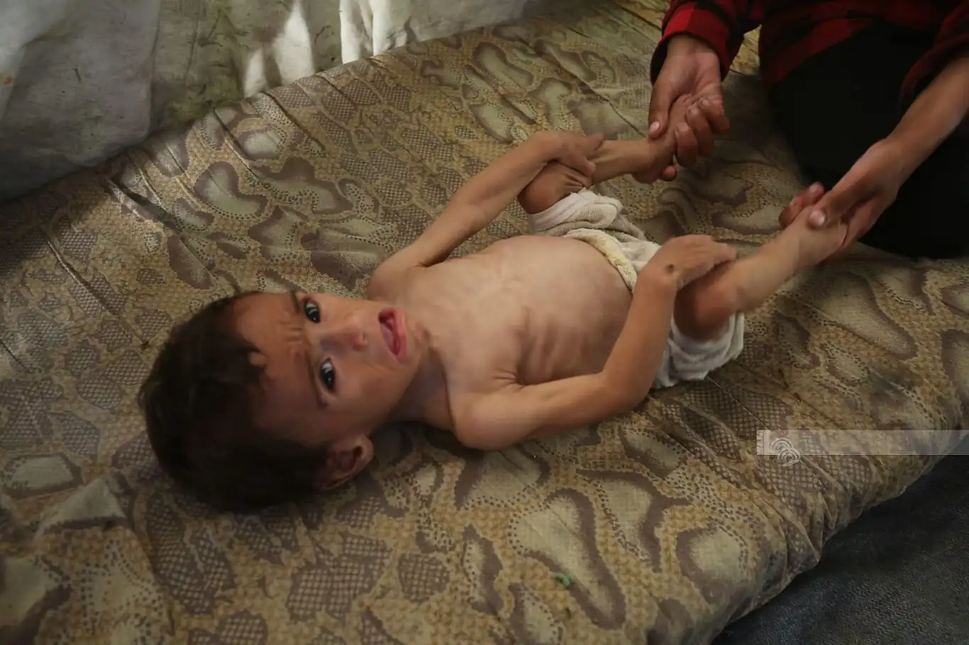 وزارة الصحة بغزة: 9 حالات وفاة جديدة بسبب المجاعة وزارة الصحة بغزة: 9 حالات وفاة جديدة بسبب المجاعة