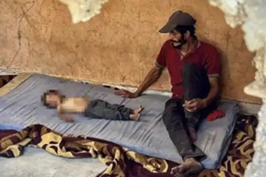 ارتفاع عدد شهداء المجاعة في غزة إلى 124 شهيدًا