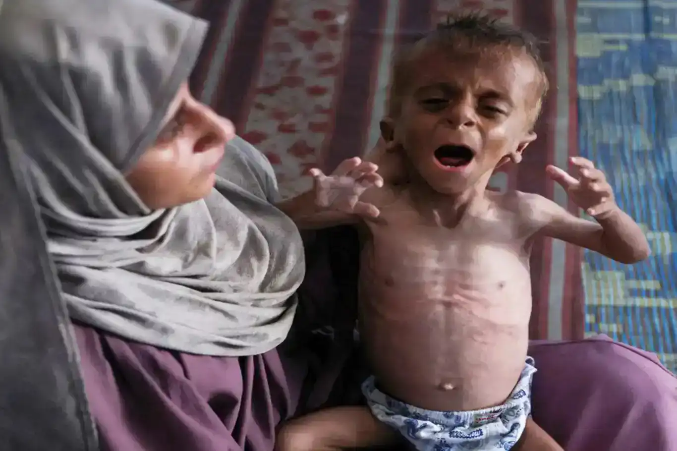 منظمات محلية ودولية تحذر: الجوع في غزة بلغ مرحلة الإبادة الجماعية منظمات محلية ودولية تحذر: الجوع في غزة بلغ مرحلة الإبادة الجماعية