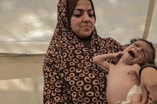 منظمة الصحة العالمية: طفل من بين كل خمسة في غزة يعاني من سوء تغذية حاد