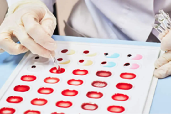 New blood group discovered in South Indian woman