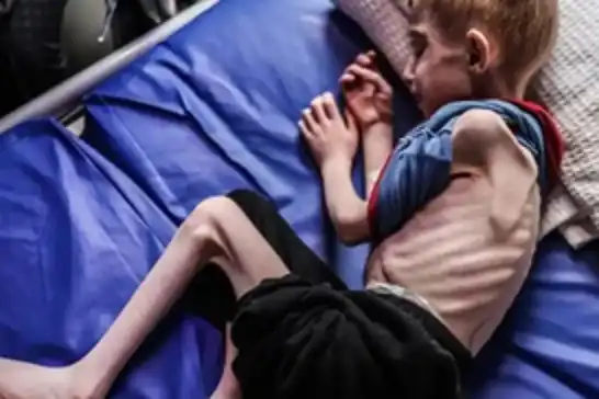 غزة..ارتفاع عدد شهداء الجوع إلى 263 بينهم 112 طفلًا