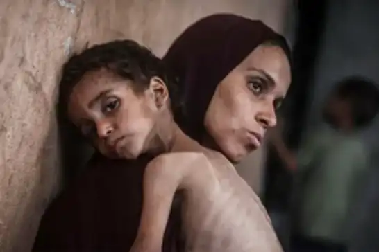 اليونيسف: الأطفال في غزة يموتون بوتيرة غير مسبوقة