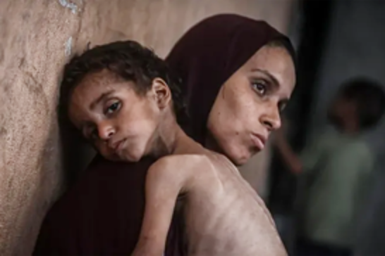 UNICEF warns of historic child deaths in Gaza as hunger reaches catastrophic levels