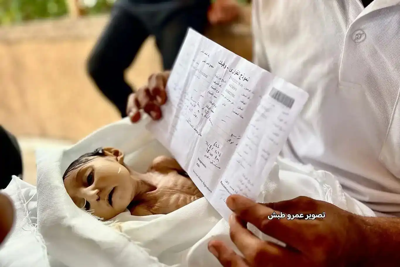 در غزه، نوزاد پنجماههای به دلیل سوءتغذیه شهید شد در غزه، نوزاد پنجماههای به دلیل سوءتغذیه شهید شد
