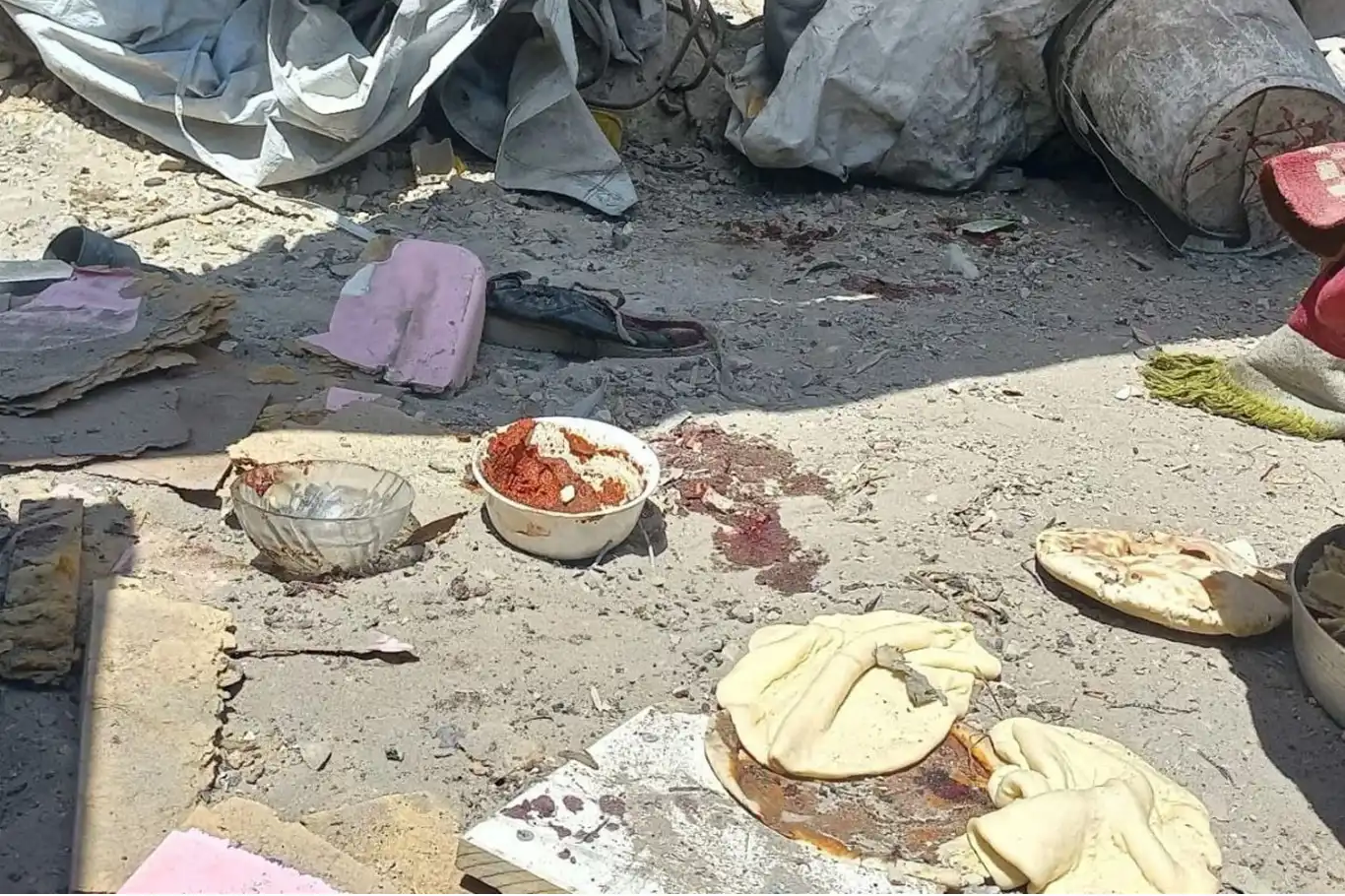 Siyonistin açlık silahı, Gazze'de bir çocuğu daha hayattan koparttı!
