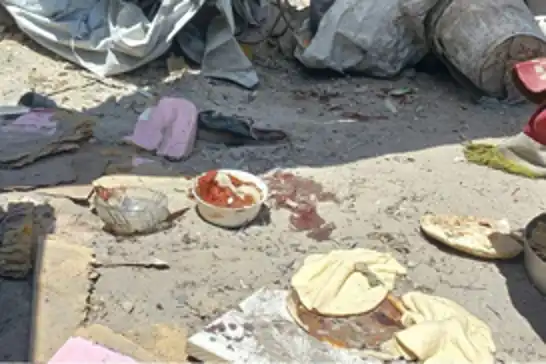 Siyonistin açlık silahı, Gazze'de bir çocuğu daha hayattan koparttı!