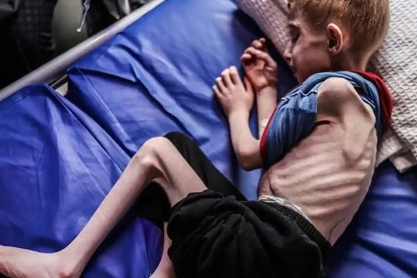 Gaza’s children starve under Israeli blockade as famine deaths rise to 339 Gaza’s children starve under Israeli blockade as famine deaths rise to 339