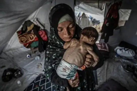وسط حصار خانق...استشهاد 7 فلسطينيين جراء الجوع خلال 24 ساعة في غزة