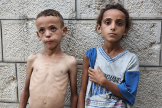 Five more Palestinians die of starvation as Gaza faces catastrophic famine