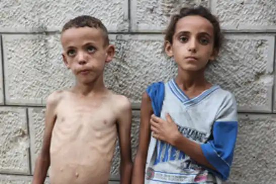 المأساة مستمرة في غزة..5 شهداء آخرين جراء التجويع وسوء التغذية