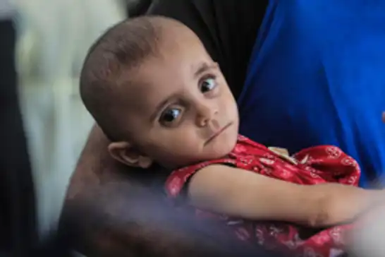 UNICEF uyardı: Gazze'de çocuklar arasında kötü beslenme oranı alarm verici seviyeye ulaştı