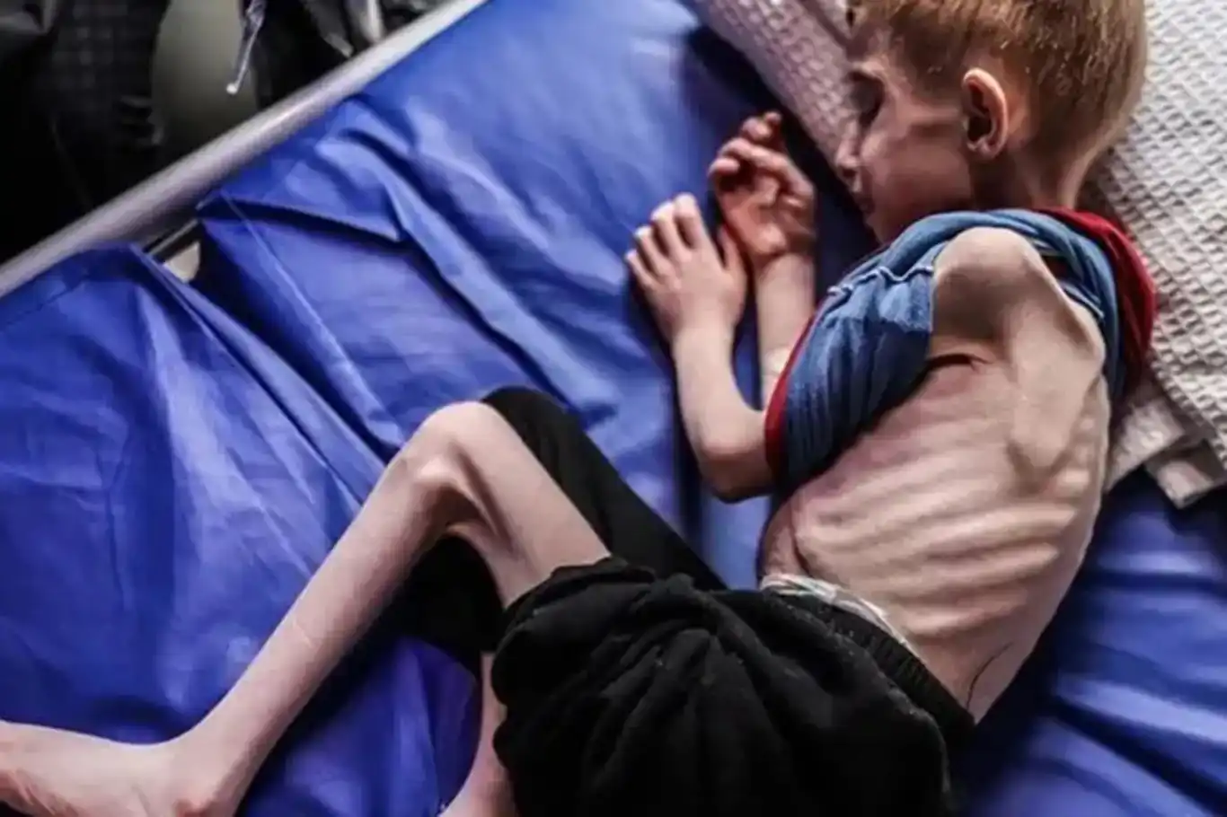 لە غەززە ١٣ کەسی دیکە بەهۆی برسێتی گیانیان لەدەستدا