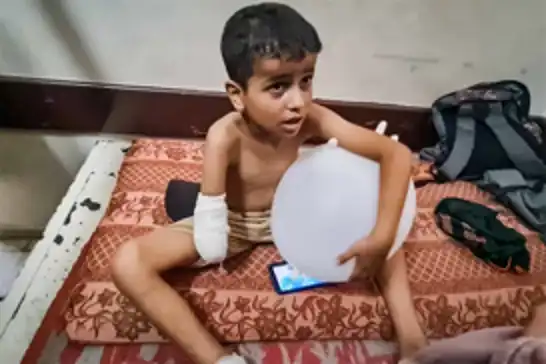 المركز الوحيد للأطراف الصناعية في غزة يكافح تحت الحصار ونقص الموارد