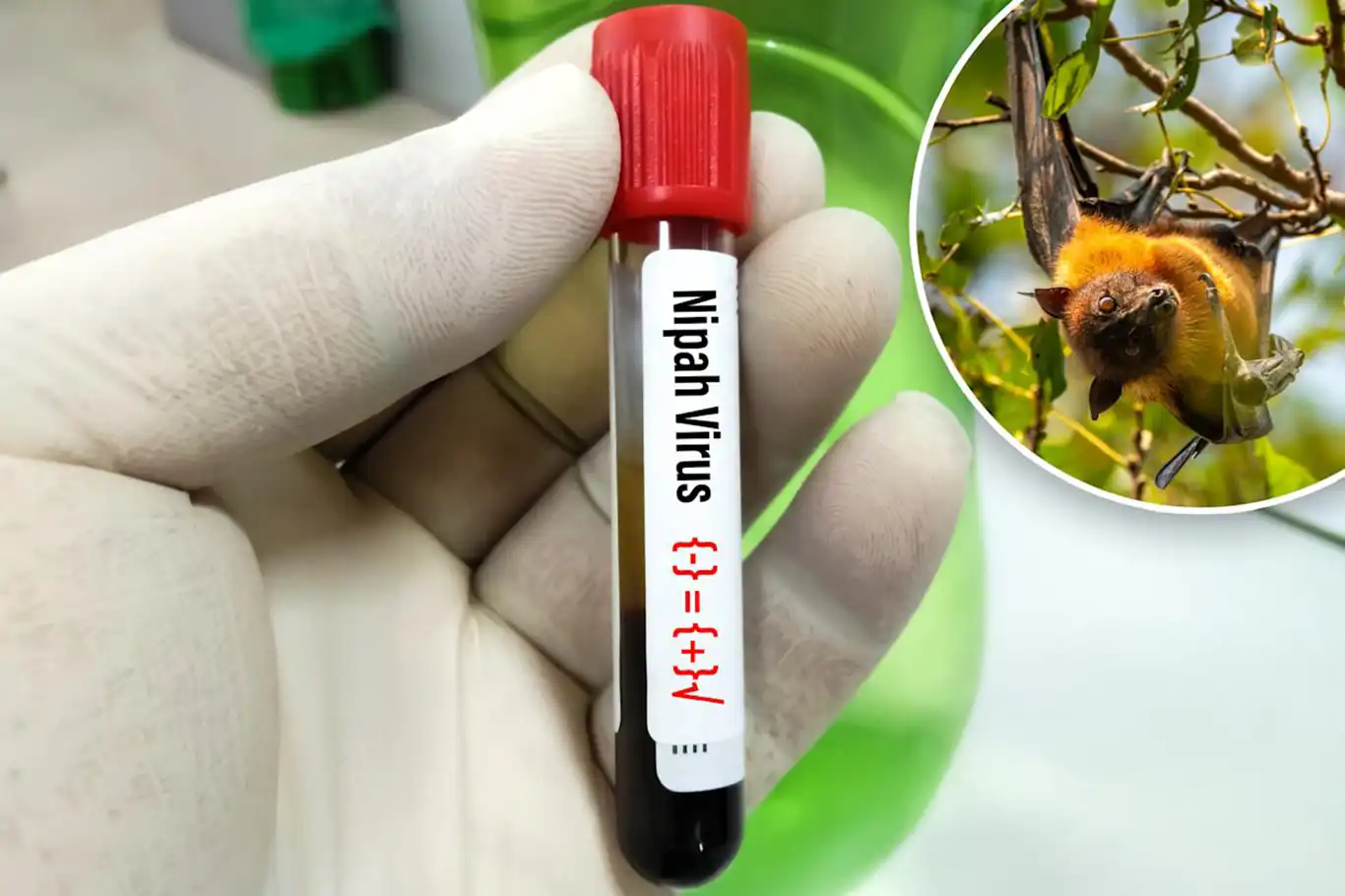 WHO confirms Nipah virus cases in West Bengal, no wider spread detected
