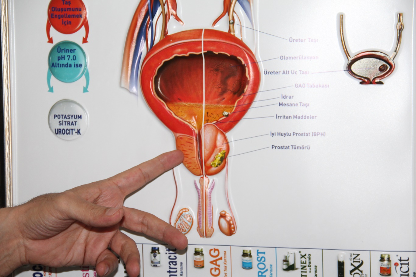 Erkeklerde prostat kanseri riski hangi yaşta artıyor? Uzmanından önemli uyarılar