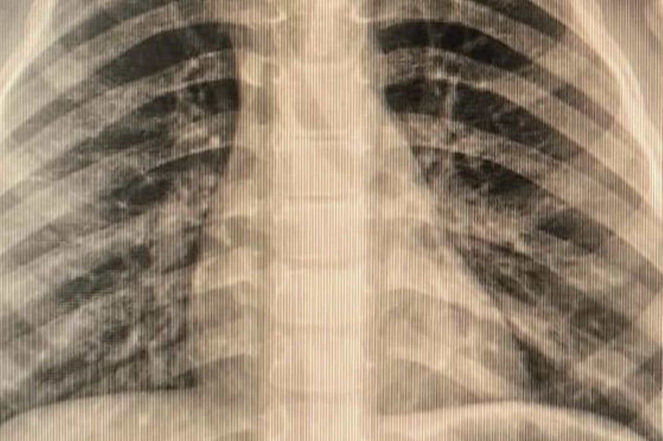 Op. Dr. Özkaya'dan çocuklarda yabancı cisim ve kimyasal madde uyarısı