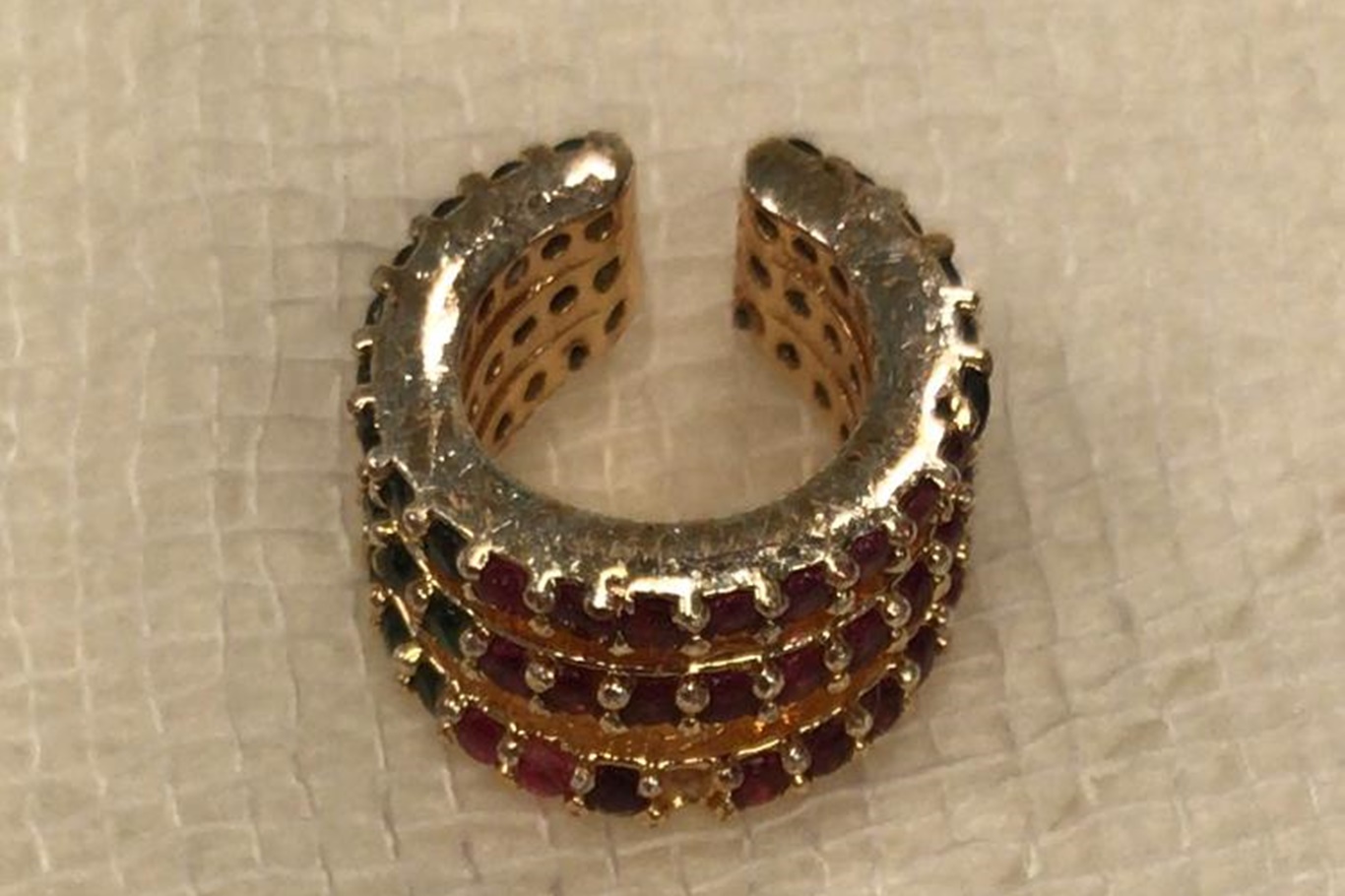 Op. Dr. Özkaya'dan çocuklarda yabancı cisim ve kimyasal madde uyarısı