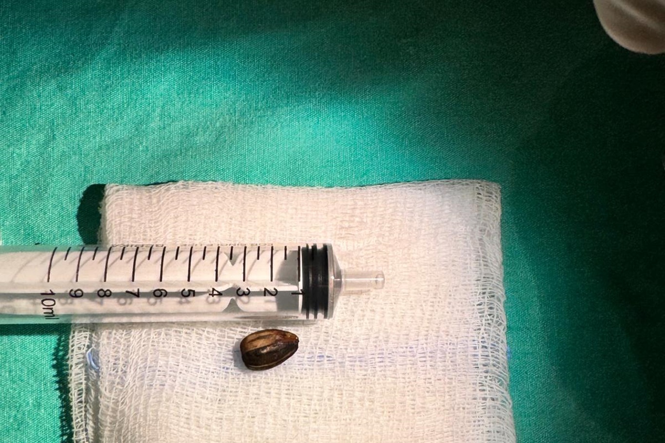 Op. Dr. Özkaya'dan çocuklarda yabancı cisim ve kimyasal madde uyarısı