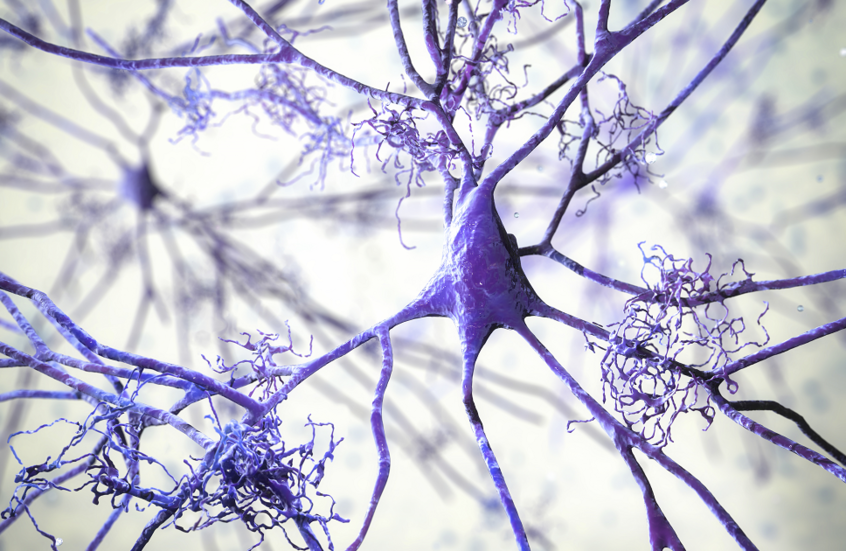 دواء شائع للصرع يواجه الزهايمر مبكراً