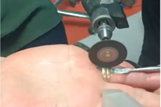 Batman'da parmağa sıkışan yüzüğe itfaiye müdahalesi