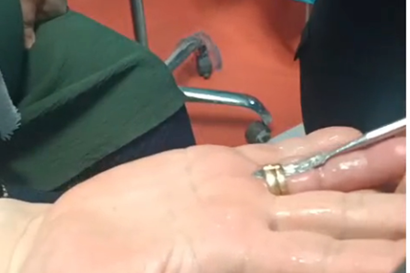 Batman'da parmağa sıkışan yüzüğe itfaiye müdahalesi