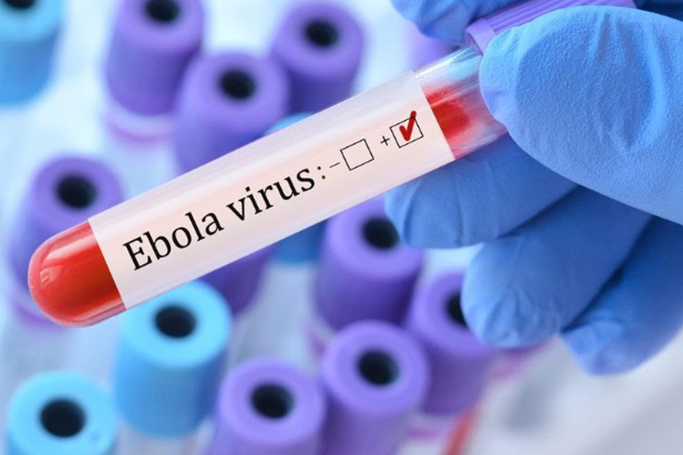 Africa CDC raises alarm as Ebola deaths surpass 200 in one month