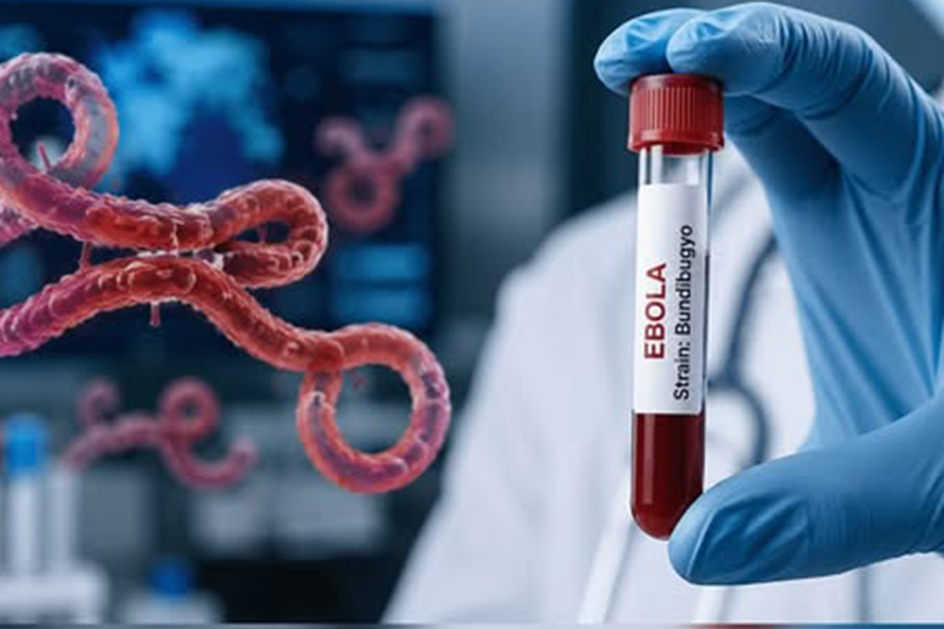 CDC warns Ebola outbreak could rival West Africa’s deadliest epidemic