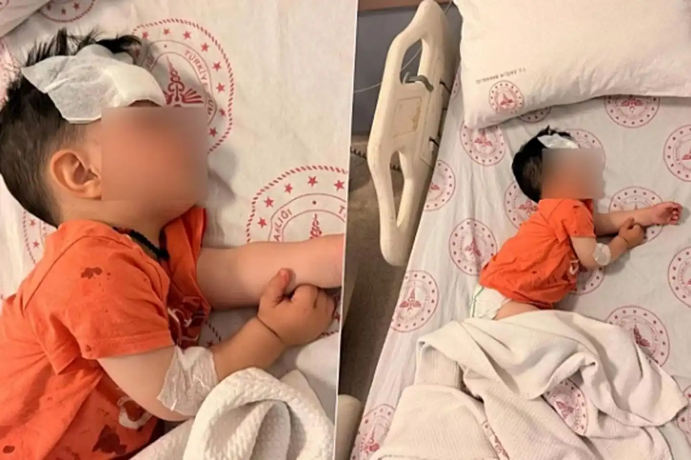 Başıboş köpek bir buçuk yaşındaki çocuğa saldırdı